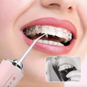 Irrigador Limpiador Oral Bucal Dental Brackets Profesional